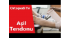 deniz algün,ortopedi,ortopedik bilgi,ortopedi uzmanı,ortopedik,aşil tendonu kopması,aşil tendonu ağrısı,aşil tendonu zedelenmesi,aşil tendonu ağrısı tedavi,aşil tendonu güçlendirme egzersizleri,aşil tendonu hikayesi,aşil tendon nedir,aş