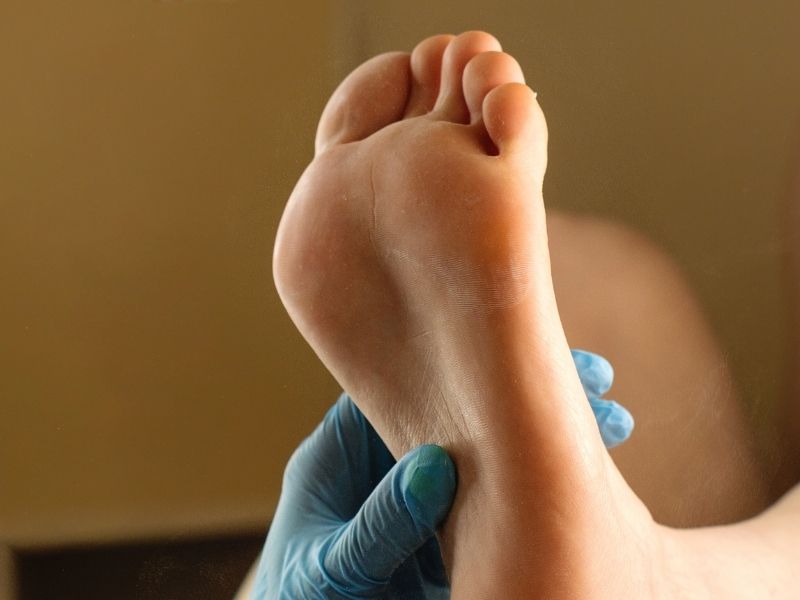 sesamoid