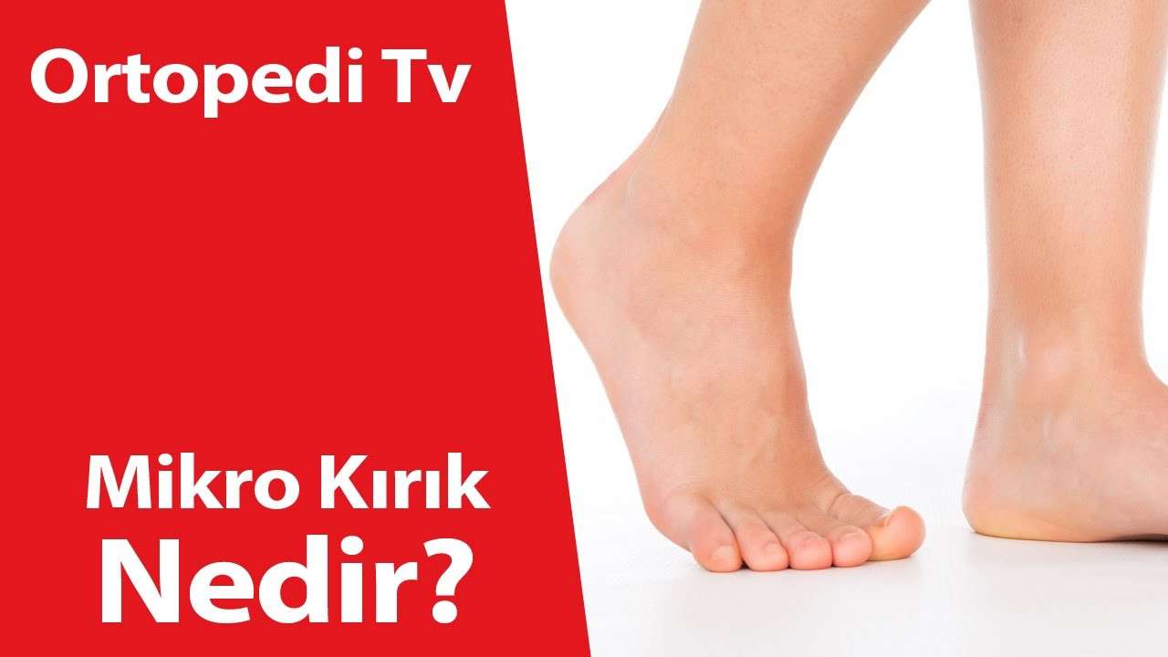 deniz algün,ortopedi,ortopedik bilgi,ortopedi uzmanı,ortopedik,Mikro Kırık,Mikro Kırık Nedir,dr deniz algün,doktor,MikroKırık Nedir,MikroKırık,MikroKırık tedavi