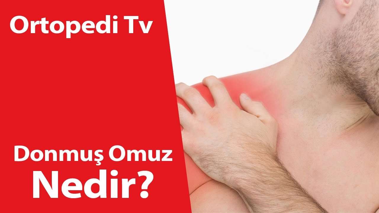 deniz algün,ortopedi,ortopedik bilgi,ortopedi uzmanı,ortopedik,Donmuş Omuz Nedir?,Donmuş Omuz,donmuş omuz egzersizleri,donuk omuz ağrısı nasıl geçer,omuz periartriti nedir,omuz donması bitkisel tedavi,periartrit nedir,donuk omuz bitkisel tedavi