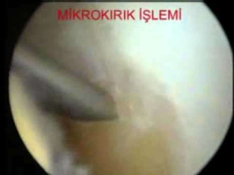 ortopedi,ortopedik bilgi,ortopedi uzmanı,ortopedik,deniz algün