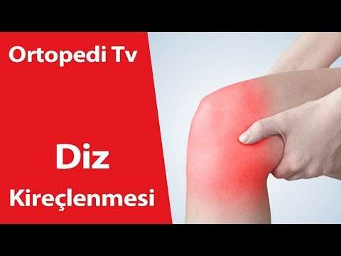 deniz algün,ortopedi,ortopedik bilgi,ortopedi uzmanı,ortopedik,Diz Kireçlenmesi ve Sebepleri,Diz Kireçlenmesi,dr deniz algün,doktor,Diz Kireçlenmesi Sebepleri,Diz