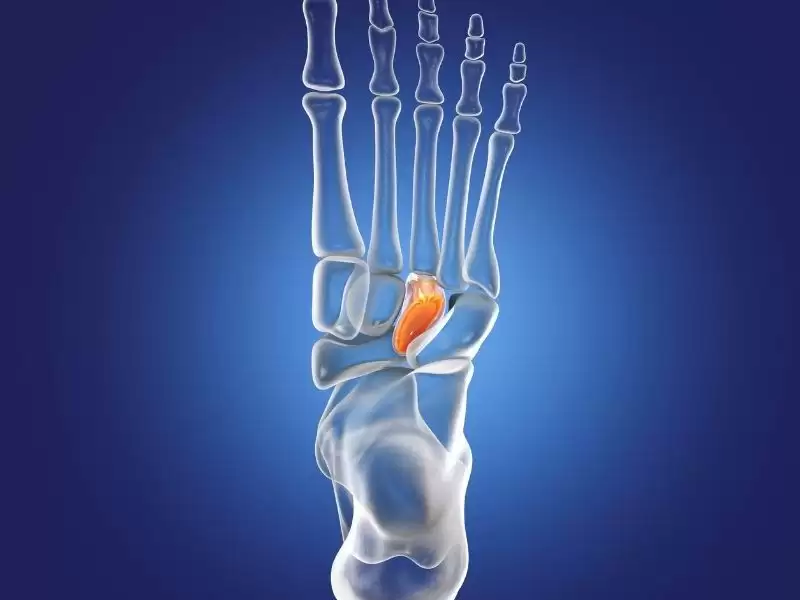 kronik-lateral-ayak-bilegi-agrisi