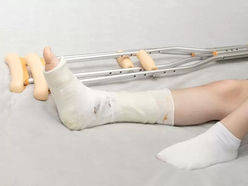 lisfranc